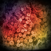 MERS-CoV, showing the spherical particles within the cytoplasm of an infected cell (Photo credit: Cynthia Goldsmith/Azaibi Tamin).