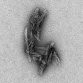 Electron micrograph of tau clusters (Image courtesy: NIAID)